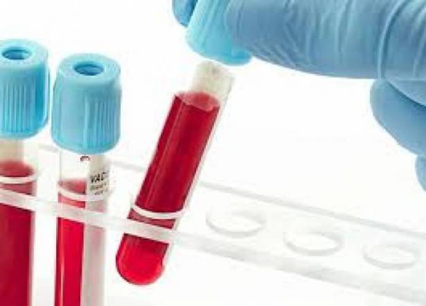 ماذا تكشف فصيلة الدم عن شخصيتك؟