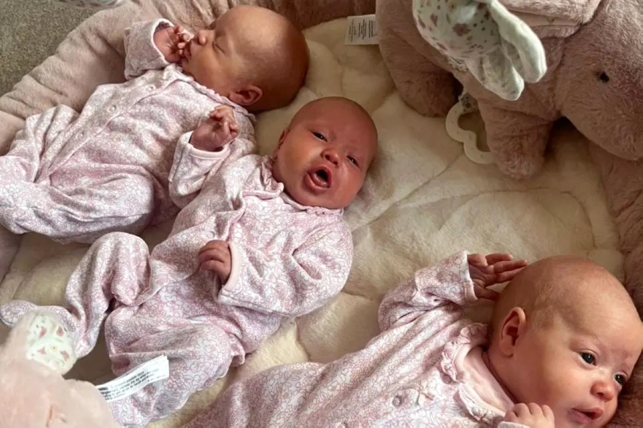3 شقيقات توأم في ولادة نادرة تحدث مرة كل 200 مليون حالة
