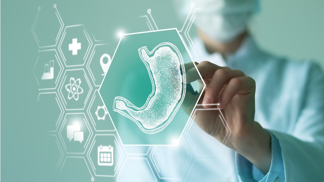 عملية تكميم المعدة.. حل مثالي للسمنة المفرطة
