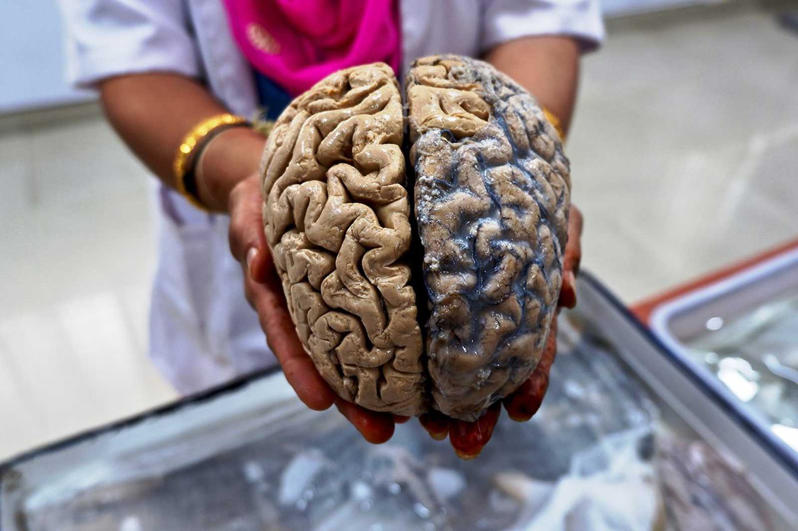 باحثون يكتشفون فرقاً بين دماغ الإنسان المعاصر وأسلافه
