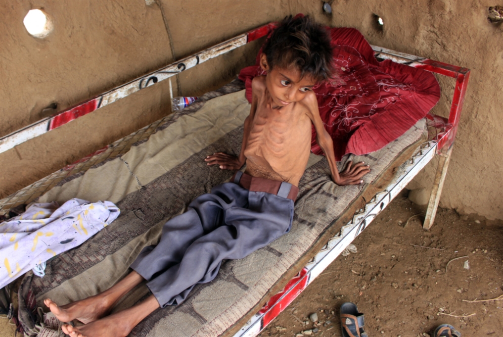 «كهوف» العمل الإنساني في اليمن: أموال أكثر... إغاثة أقلّ
