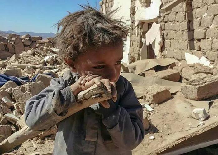 اليمن: ضحايا التحالف من الأطفال خلال الحرب بلغ أكثر من 8 آلاف بين شهيد وجريح
