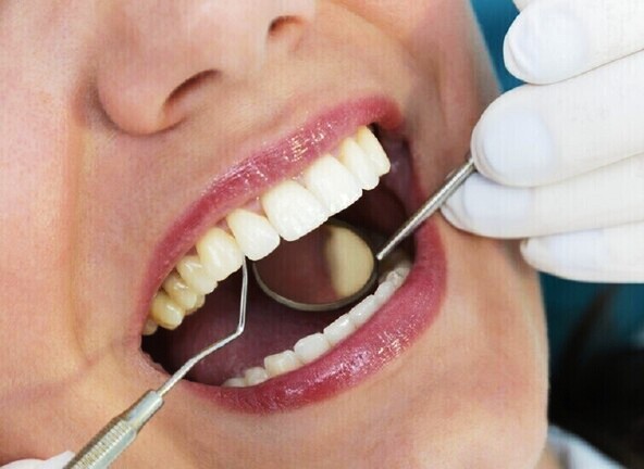 طبيبة أسنان تدعي إمكانية معرفة الحامل بفحص فمها فقط!
