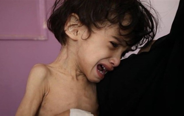 برنامج الغذاء العالمي يحذّر: اليمن يعاني أسوأ أزمة إنسانية في العالم