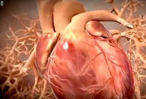 ما هي أمراض القلب وكيف تؤثر على الجسم؟