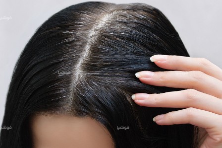 كيف يؤدي الضغط العصبي إلى ظهور الشيب في شعرك؟