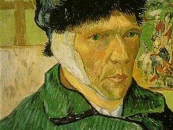 لماذا قطع الرسام الهولندي المعروف "فان غوخ" أذنه؟
