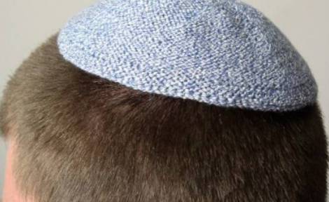 هل تعلم لماذا يرتدى اليهود قبعة صغيرة على رؤوسهم؟