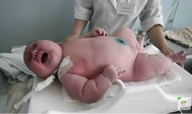 بالفيديو: ولادة أضخم رضيع على مر التاريخ بوزن قياسي بلغ 18.1 كغ