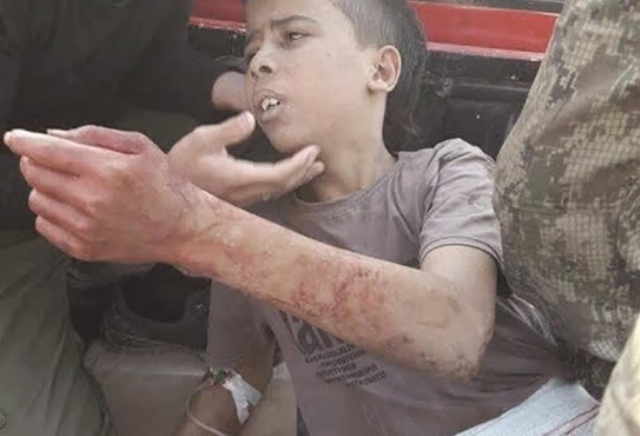 دماء "الطفل الشهيد" تهدد ميليشيا "نور الدين الزنكي" .. و"لواء القدس" يقول كلمته