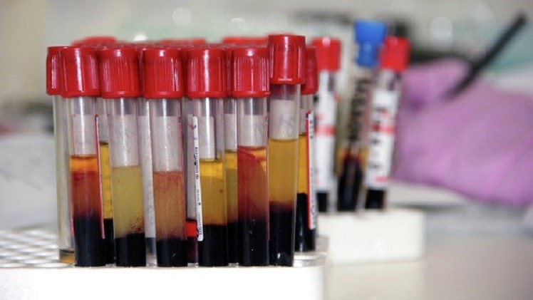 غينيا.. مجهولون يسرقون عينات دم لأشخاص يشك بإصابتهم بحمى "ايبولا"