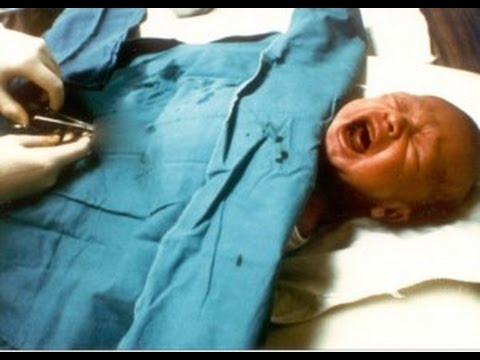 طفل يفقد عضوه الذكري خلال "تطهيره" في عيادة شعبية!