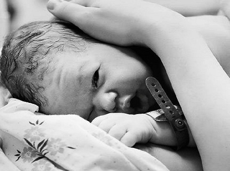 لماذا تحدث معظم حالات الولادة القيصرية في الساعة 8 صباحًا؟
